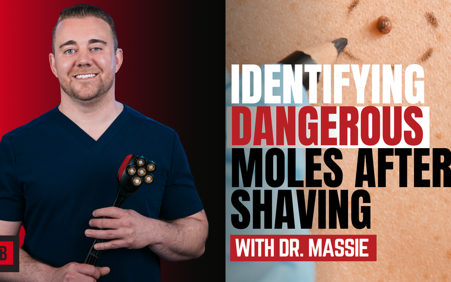 You Won't Believe What Your Moles Could Be Hiding: Tips from Dr. Michael Massie